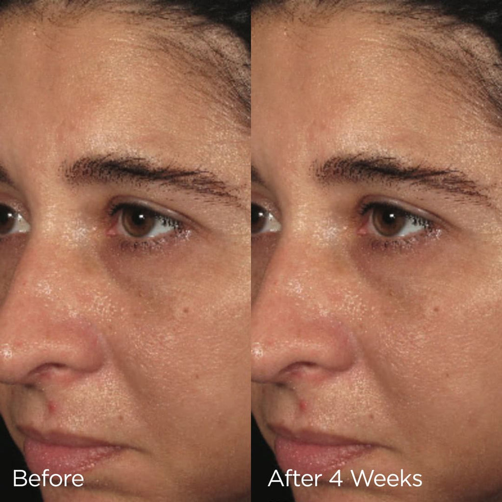 IMAGE Skincare Ormedic Balancing Biopeptide Crème